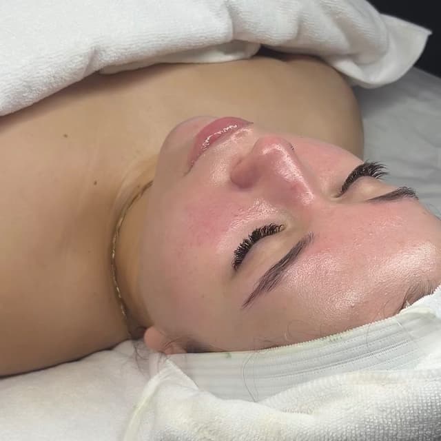 The Skin Renewal Series at The Aurora Effect in Winterhaven, FL